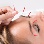 Cosmetic Acupuncture Icon Image for Naturopathic Medicine Page