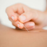 Therapeutic Acupuncture for Naturopathic Medicine Page Icon
